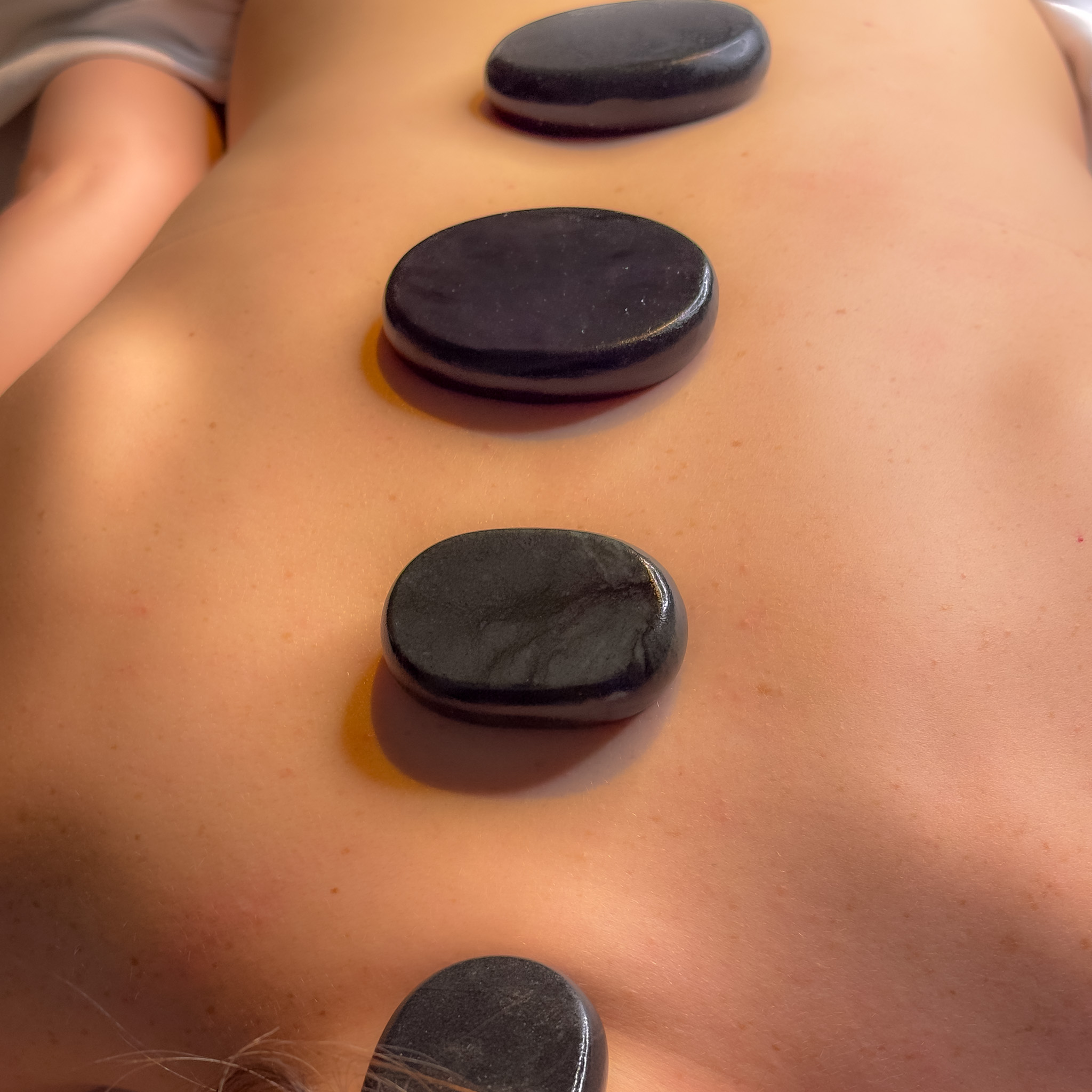 Four smooth, black hot stones rest on a person's back during a spa treatment, like during a summer spa day in Orlando at Rosen Centre.
